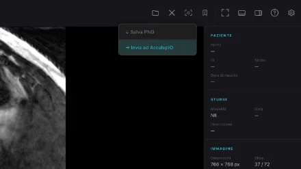 Chiron: bottone export evidenziato su un'immagine DICOM