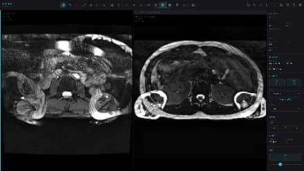 Chiron: esame DICOM live e foto ricevuta affiancate
